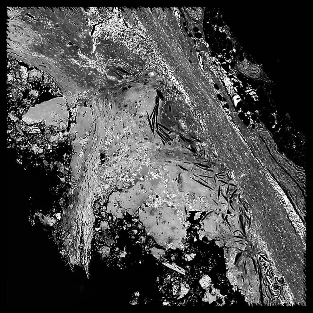 Atherosclerosis, 2020, Photography, 30 x 30 cm
