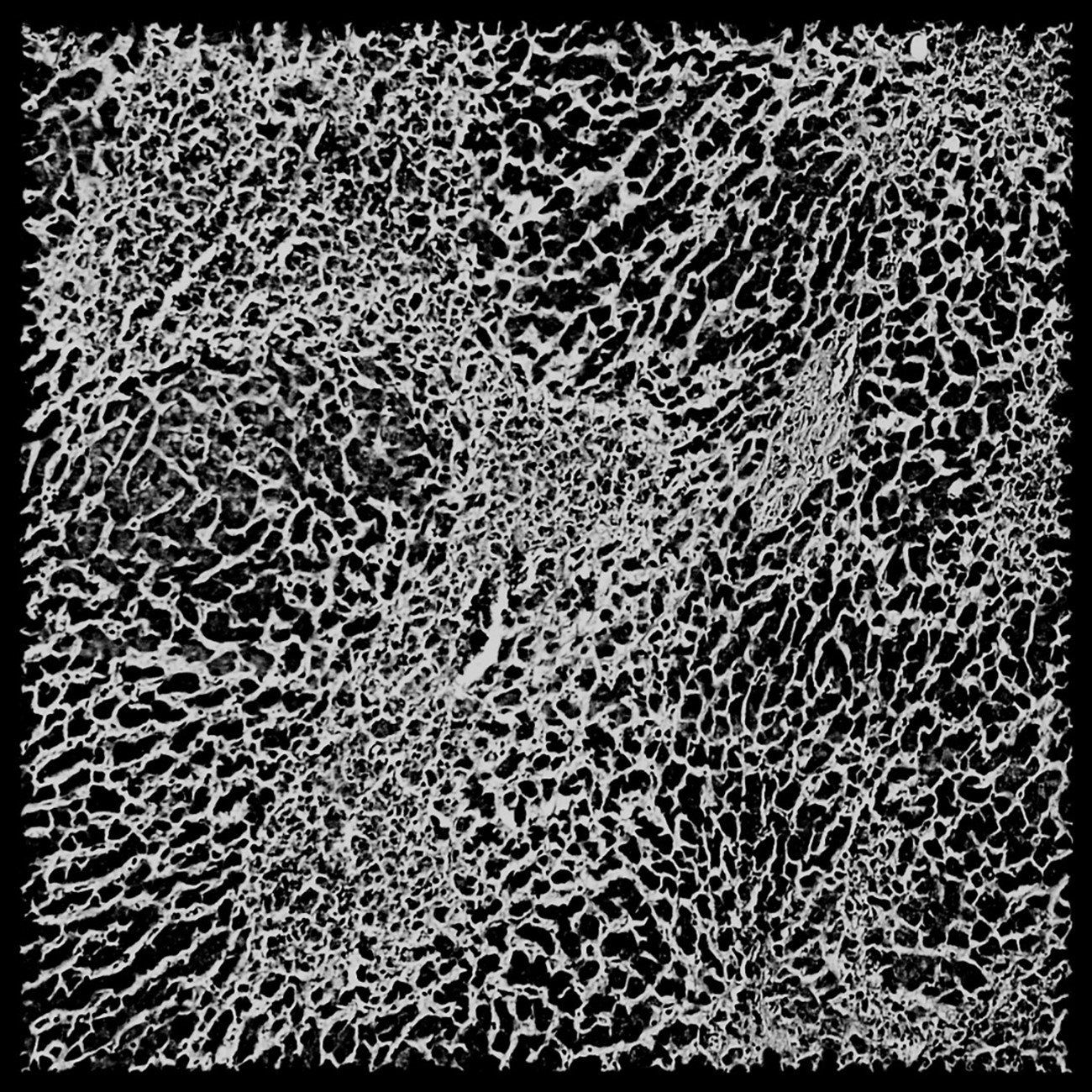 Liver failure, 2020, Photography, 30 x 30 cm