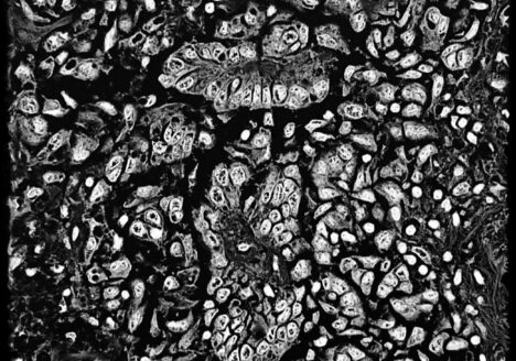 Mesothelioma, 2020, Photography, 30 x 30 cm